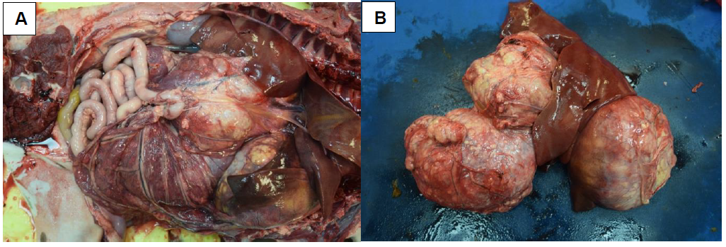 Figure 1.  E. multilocularis cysts.  A. Multiple hepatic and mesenteric cysts in situ within the abdominal cavity.  B. Two large cysts replacing liver lobes and a third mesenteric cyst.