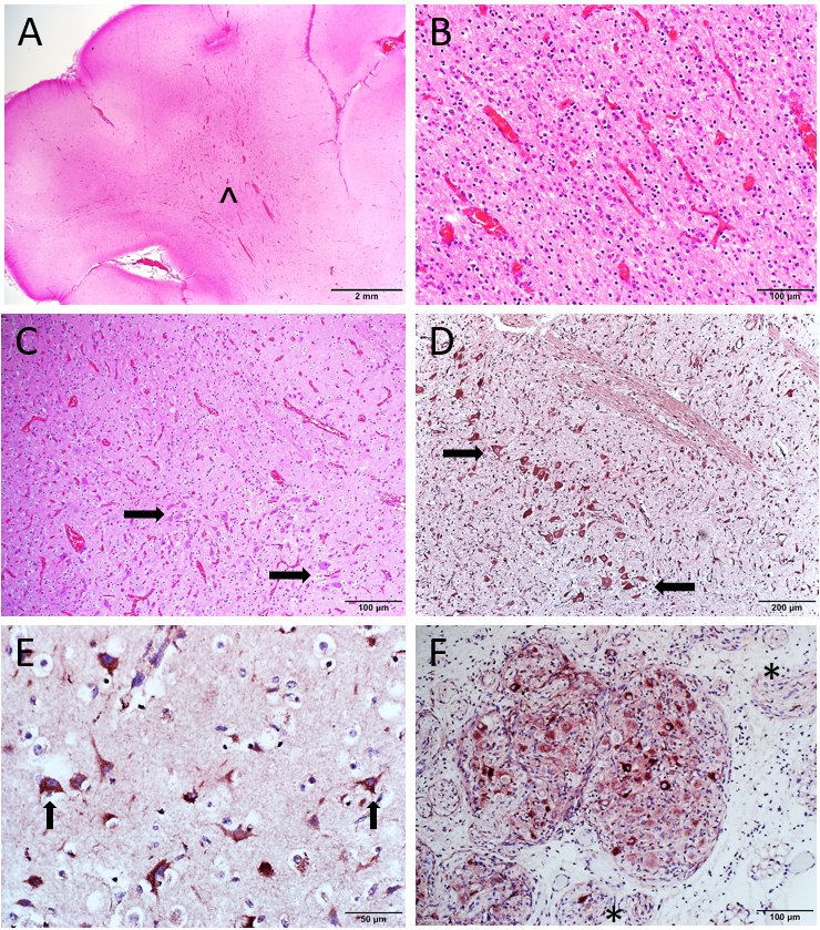  neuron cell bodies (D,E - arrows), ganglia (F) and peripheral nerves (*).  IHC 