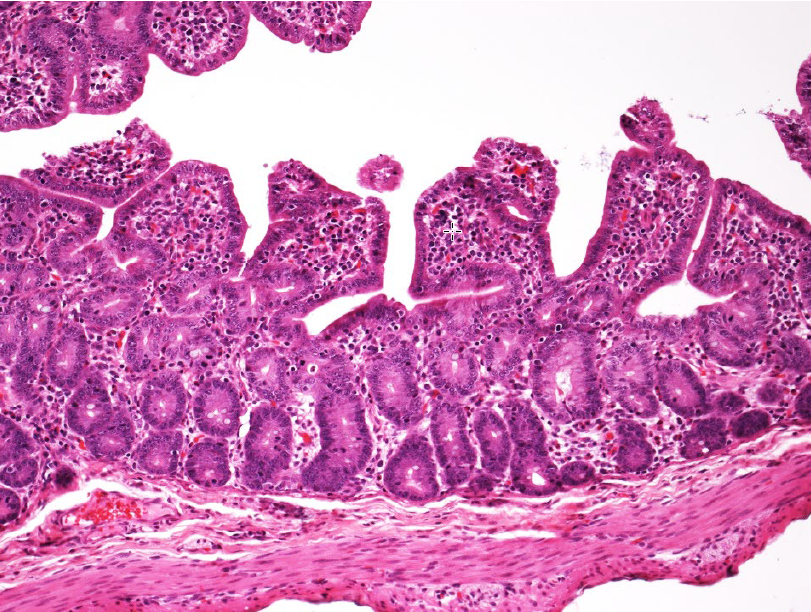 Figure 1. Atrophic enteritis in a 21-day old pig.  Villi are short and blunted, and cuboidal to jumbled epithelium covers villus tips.  PSaV nucleic acid was detected in feces by PCR (Ct 16.82).  H&E stain.