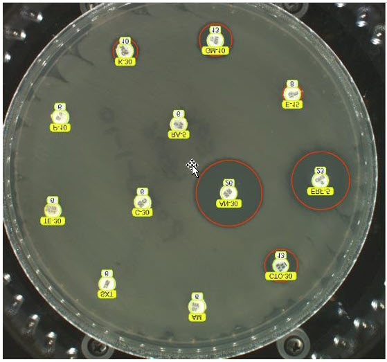 Figure 1.  Disk diffusion plate demonstrating disks impregnated with antibiotics placed on an agar plate with the bacterial species of interest.  Note the red circles highlighting the zones of inhibited bacterial growth.