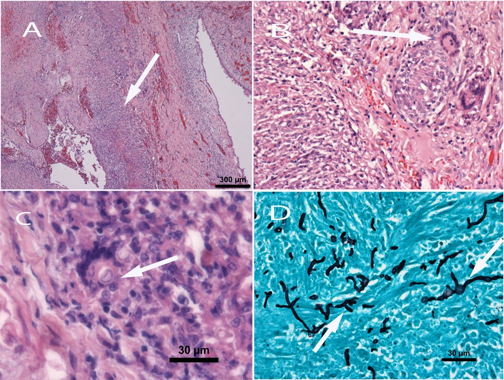 Disseminated mycosis in a German Shepherd dog. 