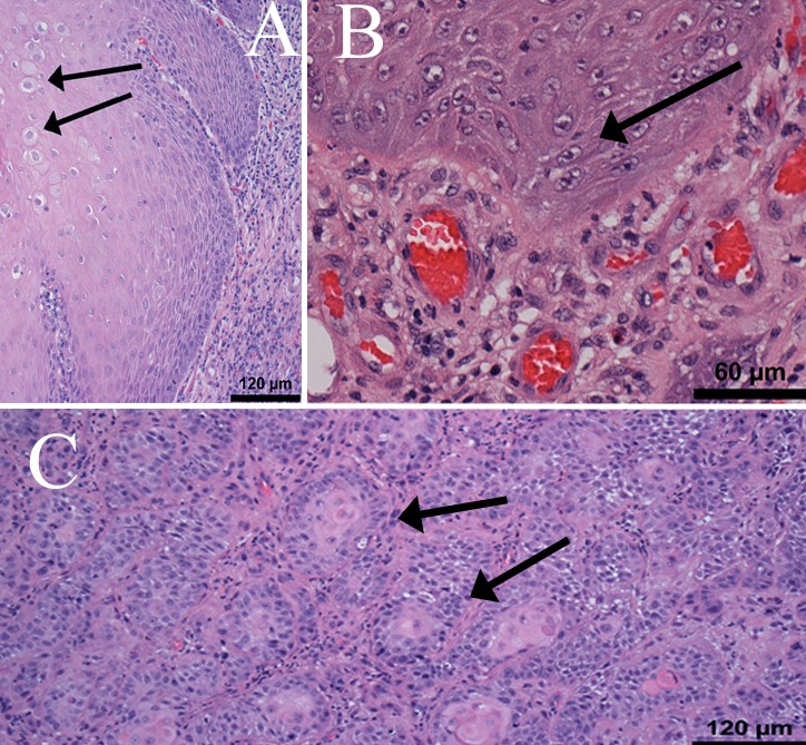 Equine penile squamous cell carcinoma. 