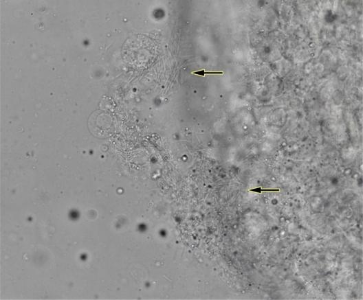 Figure 1. Gill wet mount with meshed mats of filamentous bacteria (arrows). 