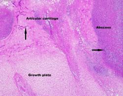 Figure 5. Fungal organisms (arrows). PAS. 