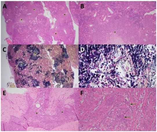 Bacterial kidney disease in farmed rainbow trout