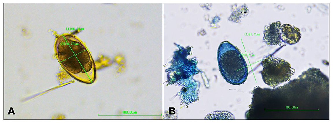 Figure 3. Fecal flotation. Unioperculated parasite ova with morphological features consistent with Cyathostoma spp. 3A. Ova recovered on fecal float. 3B. Ova stained with methylene blue showing the single polar operculum