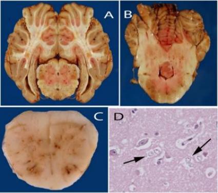Figure 1. A,B – sections of brain containing required bilateral areas of brain required for rabies testing, including hippocampus (A) cerebellum (B) and brain stem (A and B). C. Spinal cord should be submitted in cases of ascending myelitis. D. Alzheimer type II astrocytes seen cases of hepatic encephalopathy (arrows).