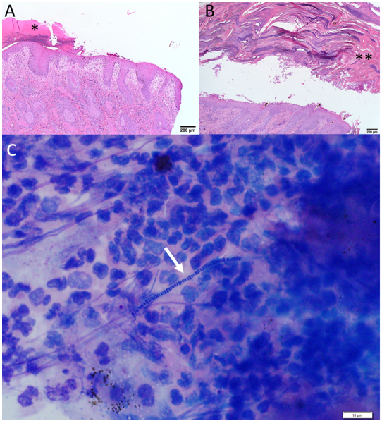 Figure 1. Dermatophilus congolensis infection in a horse