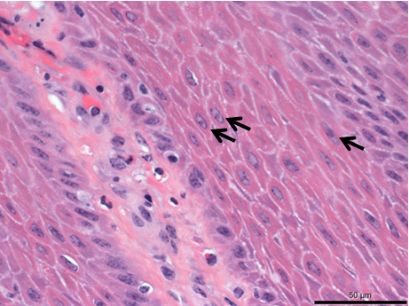Intact epithelial cells with eosinophilic intranuclear inclusion bodies and peripheralized nuclear chromatin (arrows) in teat epidermis adjacent to ulcer. 