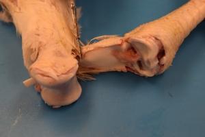 Figure 3. Gastrocnemius tendon   