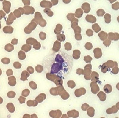 Figure 1. A neutrophil containing three A. phagocytophilum morulae.