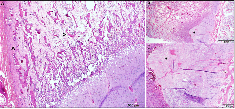 Figure 1. A. Microscopic section of humerus capturing growth plate and thin irregular trabecular (>) and cortical bone with failure of endochondral ossification and deposition of fibrous tissue (^) typical of fibrous osteodystrophy.  B, C. Microscopic sections of humeral growth plate with focally extensive tongues of retained hypertrophic cartilage arranged in poorly organized columns that extend from the physis into the metaphysis (*). H&E stain.