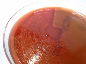 Figure 1. Strep. equi ssp. equi on a blood agar plate.