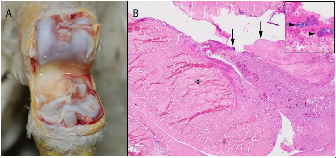  Colonies of coccoid bacteria (arrowheads) within the exudate. H&E.