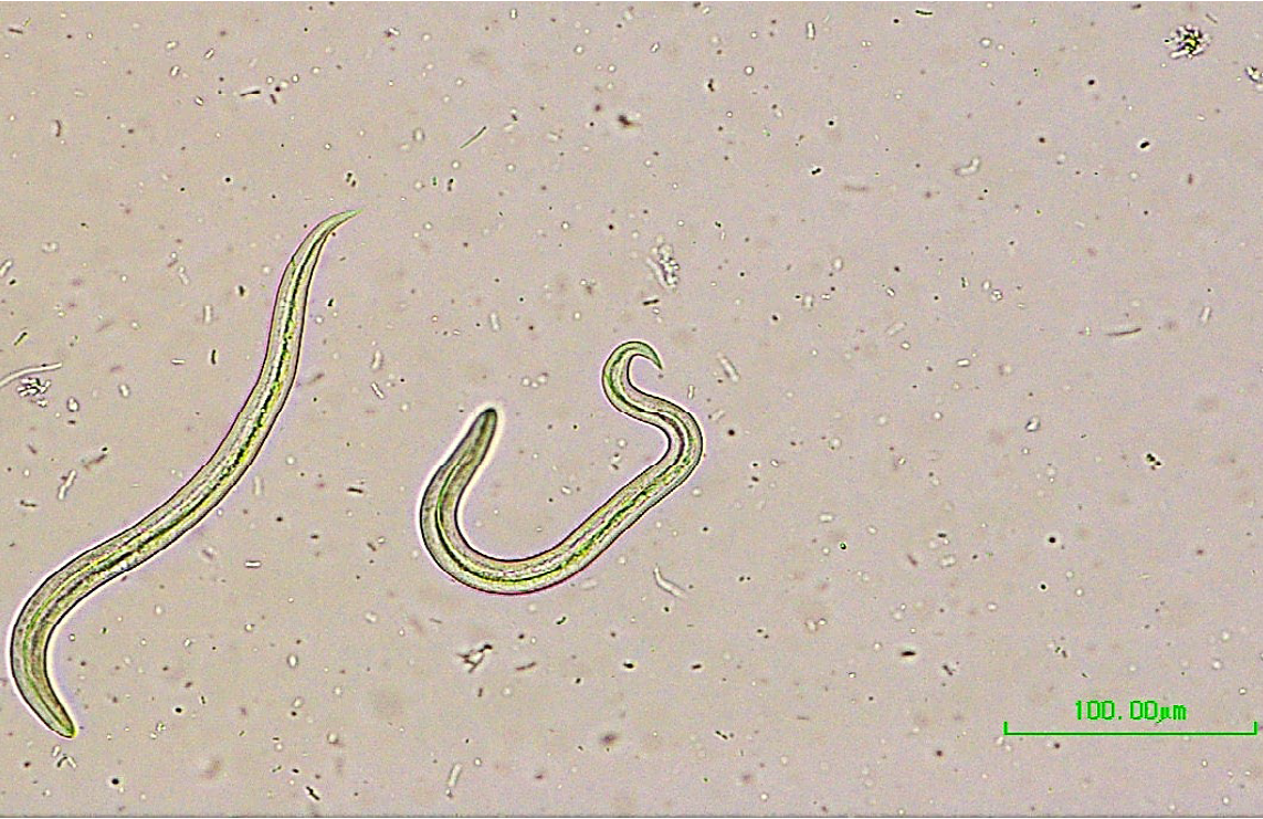 Figure 1. Crenosoma vulpis first stage larvae.