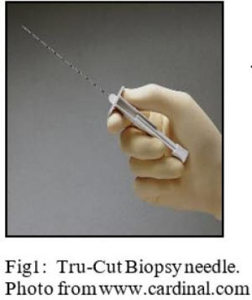   Tru-Cut Biopsy needle.  