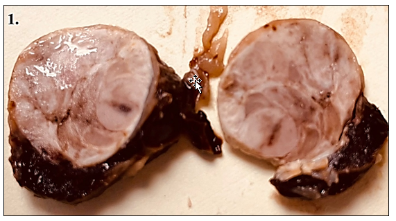 Figure 1. Formalin-fixed adrenocortical carcinoma in a 14-year-old cat. Distinctive cortex and medulla are replaced by a 2.5 cm x 2.0 cm x 1.1 cm soft, marbled light yellow to tan, encapsulated, rounded mass