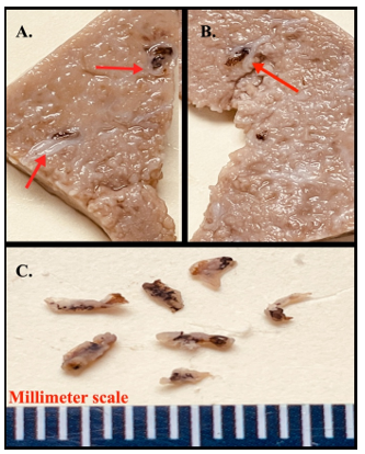 Figures 1A. & 1B. Formalin-fixed liver tissue from a 3-year-old ewe. Note the reduction of normal hepatic parenchyma and replacement with bands of intersecting fibrosis imparting a nodular appearance. Red arrows indicate bile ducts with periportal fibrosis and pigmented flukes within bile duct lumens. Figure 1C. Darkly pigmented, 3 – 6 mm long fragments of adult flukes retrieved from bile duct lumens, consistent with Dicrocoelium dendriticum (AKA lancet liver fluke).