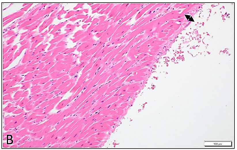  The thickness of the endocardium of the right ventricle (arrowheads) from the same cat. H&E stain.
