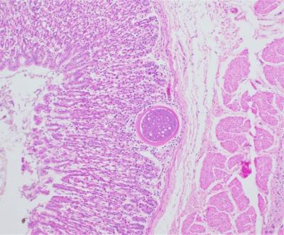 Figure 1. Eimeria gilruthi megaloschizont in the abomasal mucosa with thick eosinophilic capsule, 10X magnification.  H&E stain