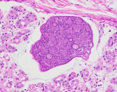 Figure 2. Eimeria gilruthi megaloschizont in abomasal mucosa. Note merozoites arranged in circular blastophores, 40X magnification.  H&E stain.