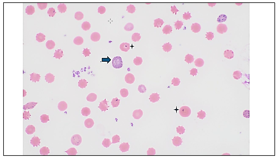 Figure 1. Peripheral blood smear with evidence of polychromasia with basophilic stippling (arrow) and intraerythrocytic piroplasms of Theileria orientalis Ikeda (stars). H&E stain.