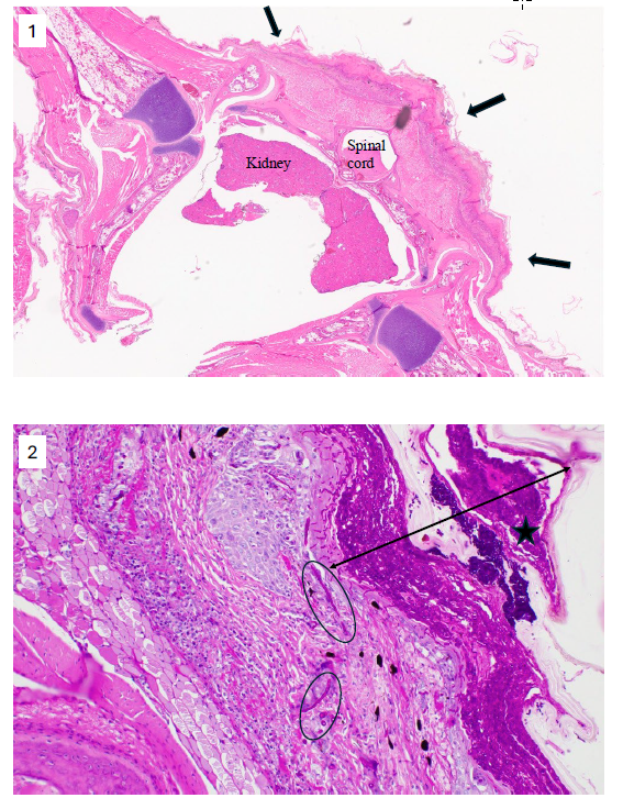 Histological changes associated with an inland bearded dragon (Pogona vitticeps) with yellow fungus disease. Figure 1. H&E-stained cross section of the rostral pelvic cavity and caudal body. The dorsal midline contains a large region of full thickness epidermal ulceration that is overlain by a thick surface crust of necrotic keratin debris (arrows).  Figure 2. PAS-stained higher magnification of the ulcerated region and crust. The crust (double-headed arrow) is widely permeated by a dense mat of deep magenta hyaline fungal hyphae that extend into the exposed inflamed dermis (ovals). Abundant clusters of spores are present along the outer debris (star) which represent a significant source for environmental and fomite contamination and transmission. 