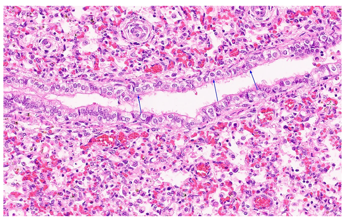 Figure 2. Histological findings in an aborted fetus infected with non-neuropathogenic equine herpesvirus-1. A few bronchiolar epithelial cells contain an eosinophilic intranuclear viral inclusion body with marginated chromatin (arrows). H&E stain.
