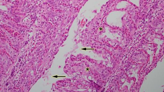 Figure 3. Higher magnification of the gill with fused gill lamellae (asterisks) with surface colonies of filamentous bacteria (arrow)