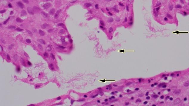 Figure 4. Surface colonies of meshed filamentous bacteria (arrows).