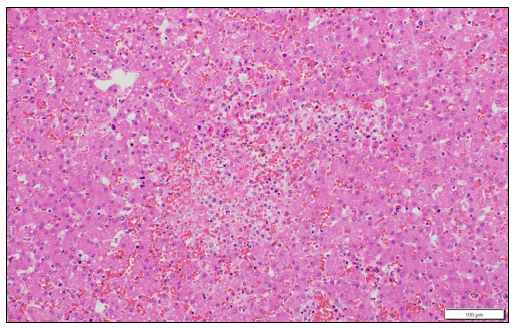 Figure 3. Liver. Acute hepatocellular necrosis and hemorrhage. H&E, 20X.