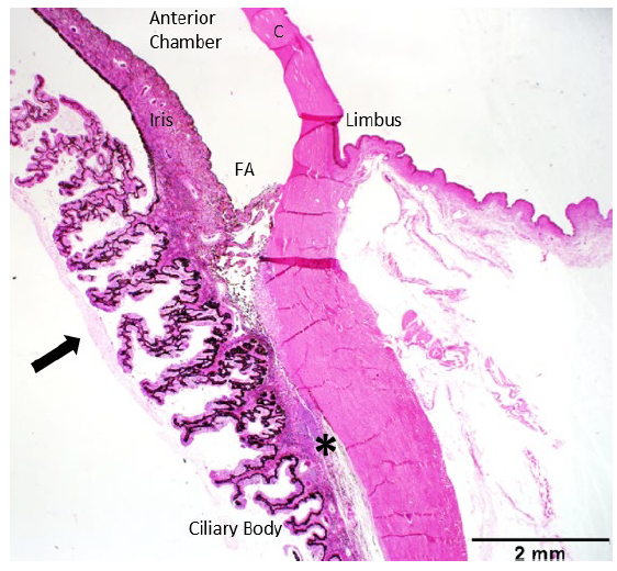 Figure 1. Microscopic section of the eye (H&E, 1.25x) demonstrating lymphoplasmacytic inflammation in the ciliary body stroma (*) and proteinaceous membrane with inflammatory cells along the posterior aspect of ciliary body processes (arrow). Cornea= C, filtration angle= FA.