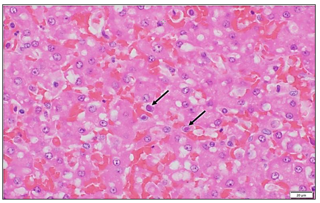Figure 1. Section of liver showing congestion, vacuolation, and single cell death indicating hepatic injury, as well as multiple large basophilic intranuclear viral inclusions (arrows). H&E stain.