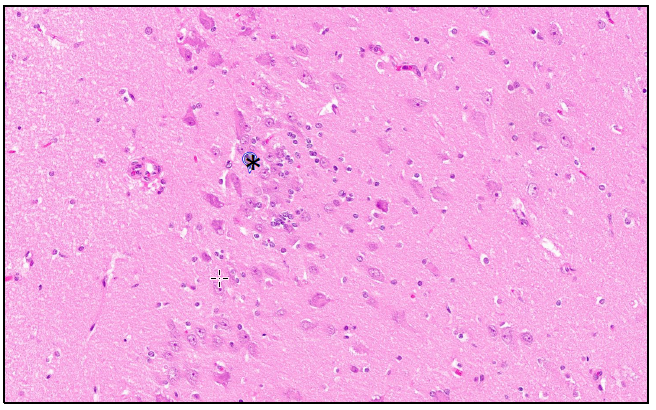 Figure 2. Brain from a 14-week-old puppy.  There are rare clusters of increased glial cells (*) in the cortical grey mater (H&E stain, 20x)