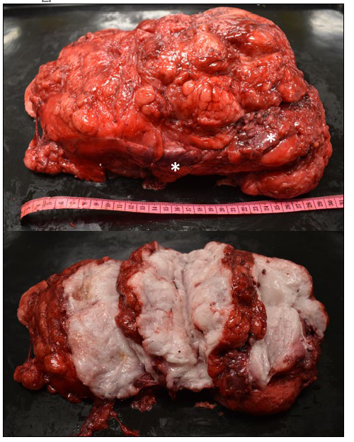 Figure 1. Photograph of the 36 x 21 x 12 cm lipoma excised from the left body wall of a dog during gross examination and sample collection at the Animal Health Laboratory. Note the presence of a few slender pieces of striated muscle at the periphery (*).