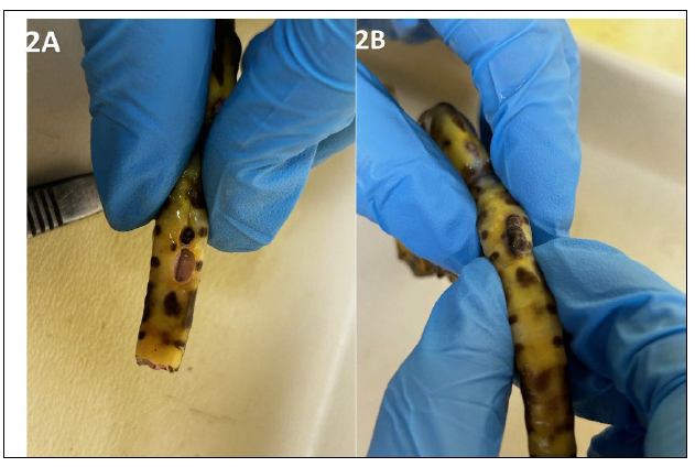 Figure 2. Postmortem findings in a captive big-belly seahorse with tail swelling. A. There is a regional defect within the ventral surface of the tail base with protruding dark grey-black pigmented dermal tissue. B. Gentle digital pressure results in protrusion of the masses through the opening