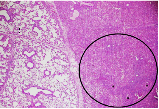 Figure 2.  Nursing pig.  Microscopic section of lung (H&E stain, 4x).  Affected lobules on the right half of the image correspond to the grossly noted areas of lobular atelectasis, and multiple small airways contain luminal accumulation of neutrophils (*), accompanied by mild alveolar edema with variable accumulation of macrophages and neutrophils