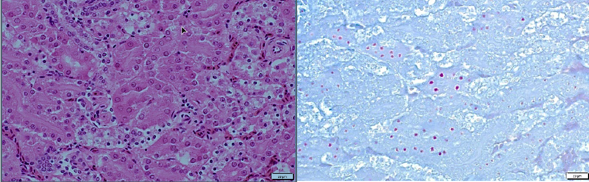 Figure 2. Kidney, H&E, 60X.  Intranuclear inclusion bodies in renal tubular epithelium (left).  Kidney, Ziehl-Neelsen, 60X.  Acid-fast intranuclear inclusion bodies in renal tubular epithelium (right).