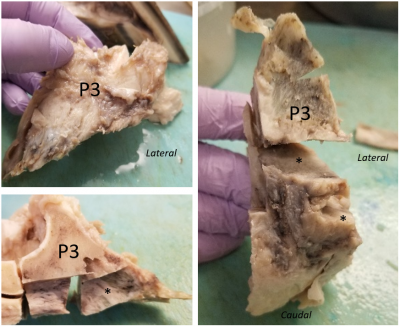 Figure 2. Gross images of the lateral half of P3, with asterisks (*) denoting an infiltrative mass effacing bone.