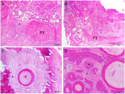 Figure 3. Histologic images of the infiltrative mass effacing the bone of the distal phalanx, with asterisks (*) denoting neoplastic epithelial cells and arrowhead (^) indicating the supporting fibrous stroma. H&E stain