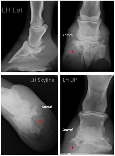 Figure 1. Radiographs of the left hind hoof, with asterisks (*) denoting a soft tissue opacity associated with regionally extensive lysis of the lateral aspect of P3.