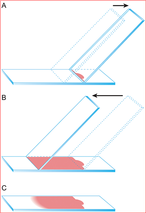 Blood smear technique