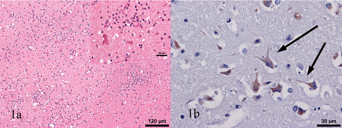 Cerebral cortex of EEEV-infected horse. 