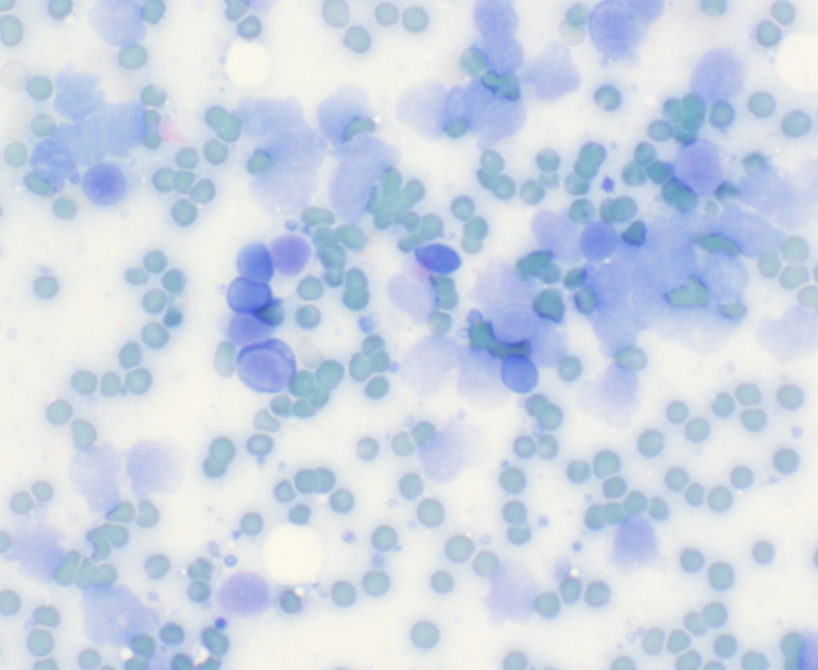 Cytology smear exposed to formalin fumes before staining.