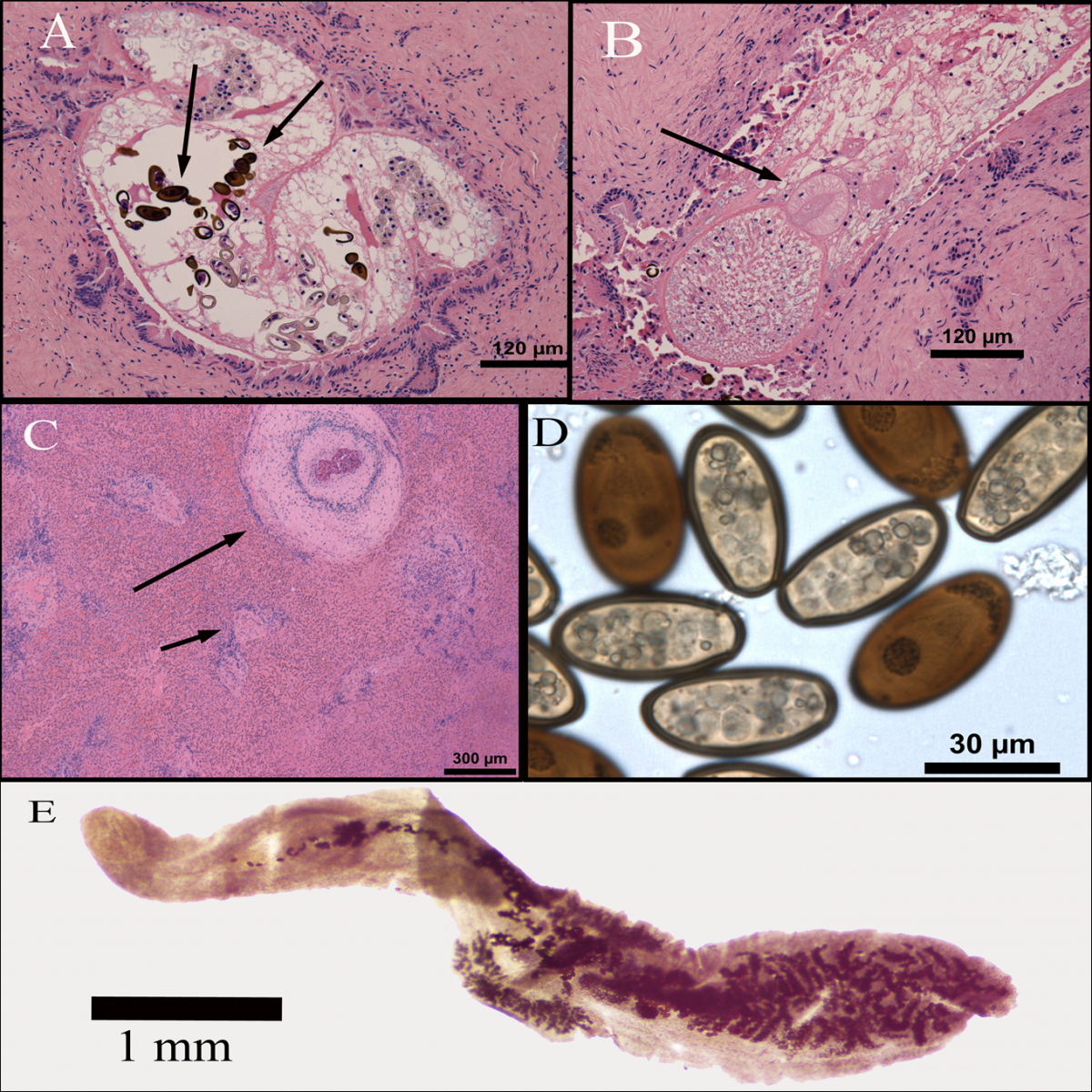 Dicrocoelium dendriticum images