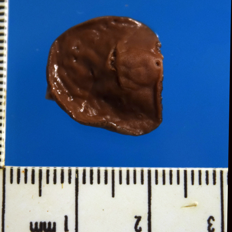 Figure 4. Fascioloides magna fluke found in the liver.