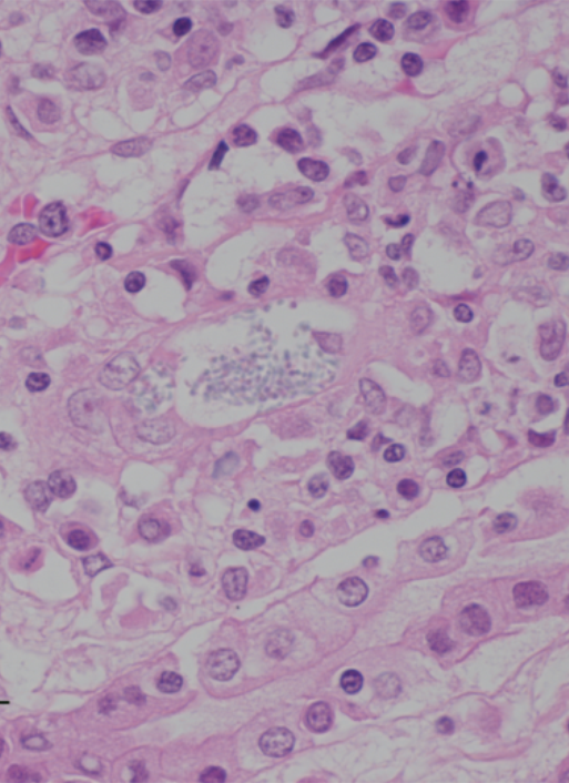 Organisms in kidney, H&E stain.