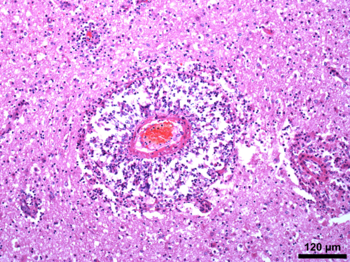 Severe meningoencephalitis in a 4-year-old Thoroughbred. 