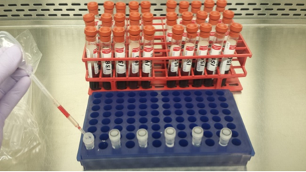 Example of splitting serum samples, and racks