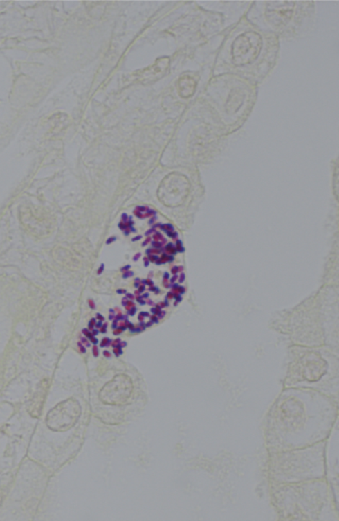 Organisms in kidney, B&B Gram stain.